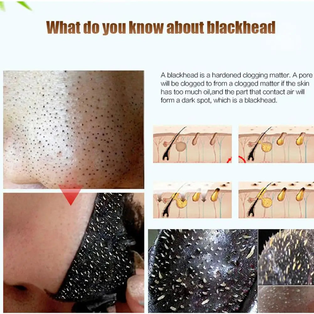 Plant Extraction Blackhead Remover Peel-Off Mask | All Skin