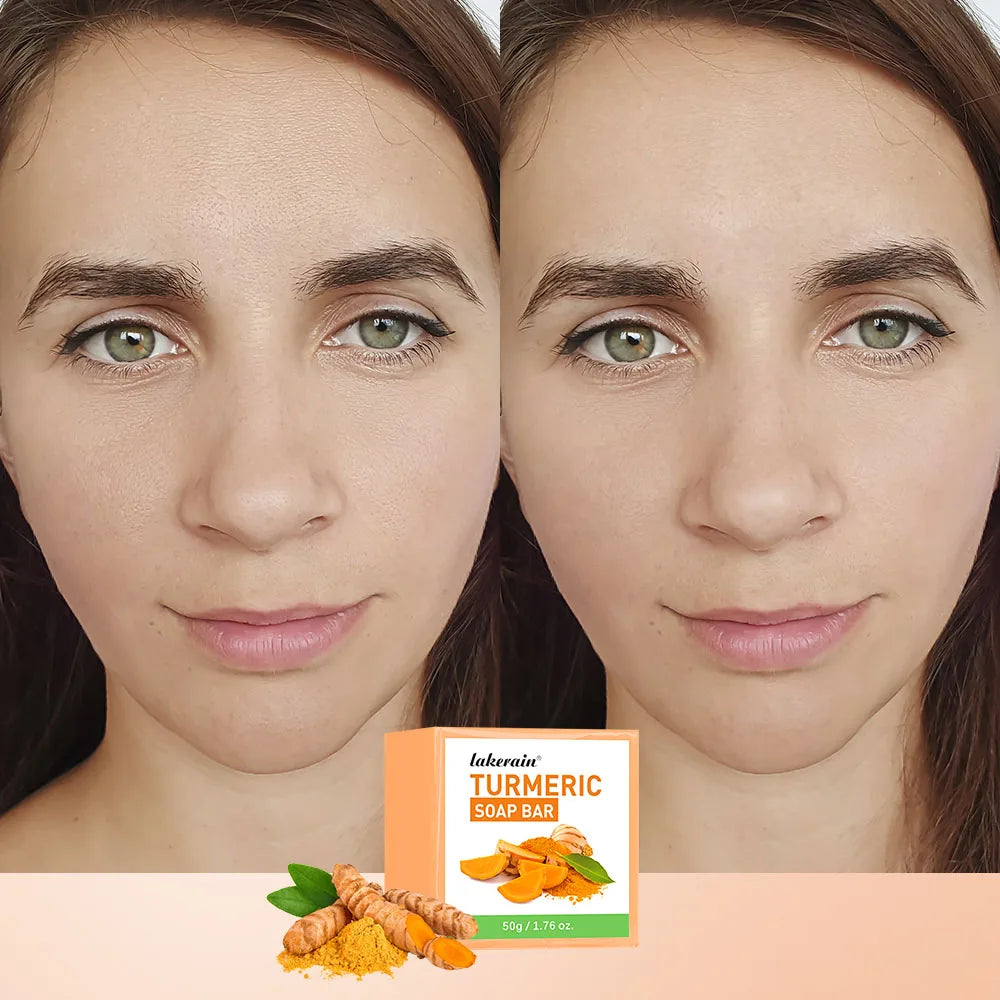 Turmeric Kojic Acid Soap Bar – Natural Brightening & Exfoliating