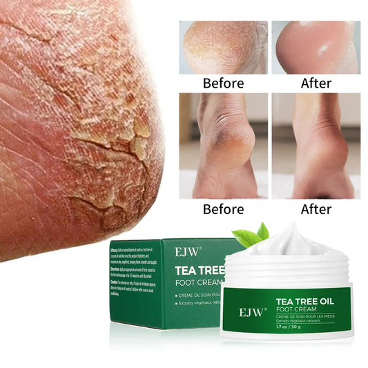 Tea Tree Oil Foot Cream – Dry Cracked Heels & Callus Balm Foot Cream Balm Oasis Select