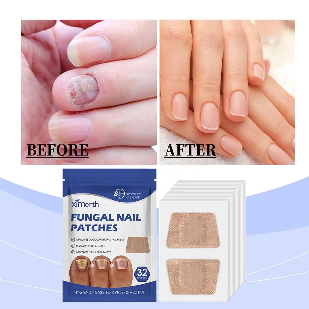 Nail Care Repair Patch – Nourishing & Protective | 1-3 Pcs