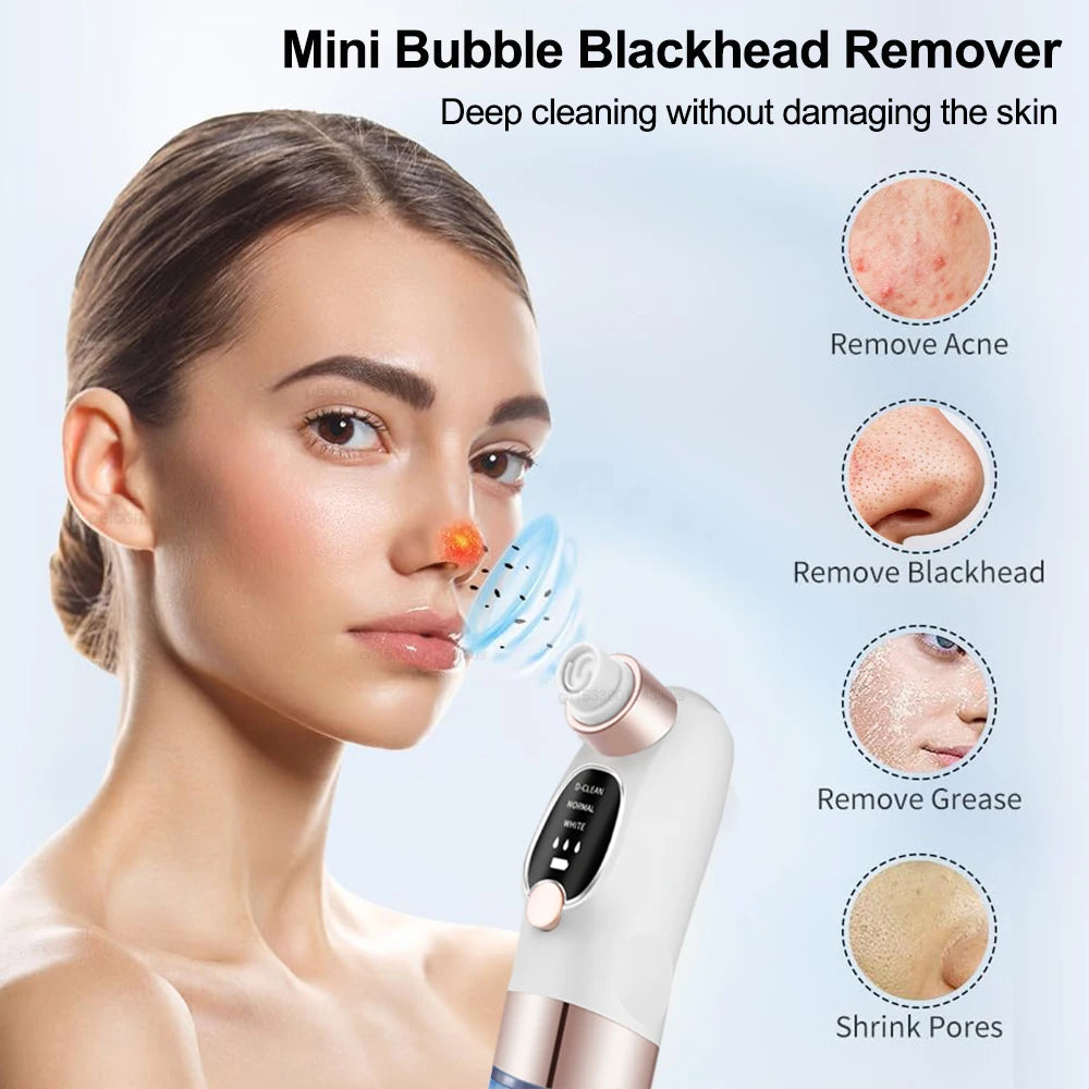 Blackhead Remover Pore Cleaner Black Dots Vacuum Cleaner Skin Pimple Acne Extractor Facial Cleaning Electric Black Head Removal Peaceful Pleasures Health and Wellness