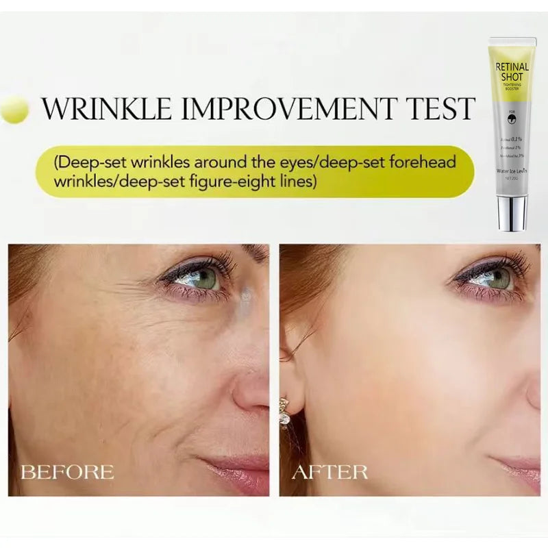 Retinal Eye Serum 0.1% Retinal & 3% HA – Firm & Moisturize Eye Serum Peaceful Pleasures Health and Wellness