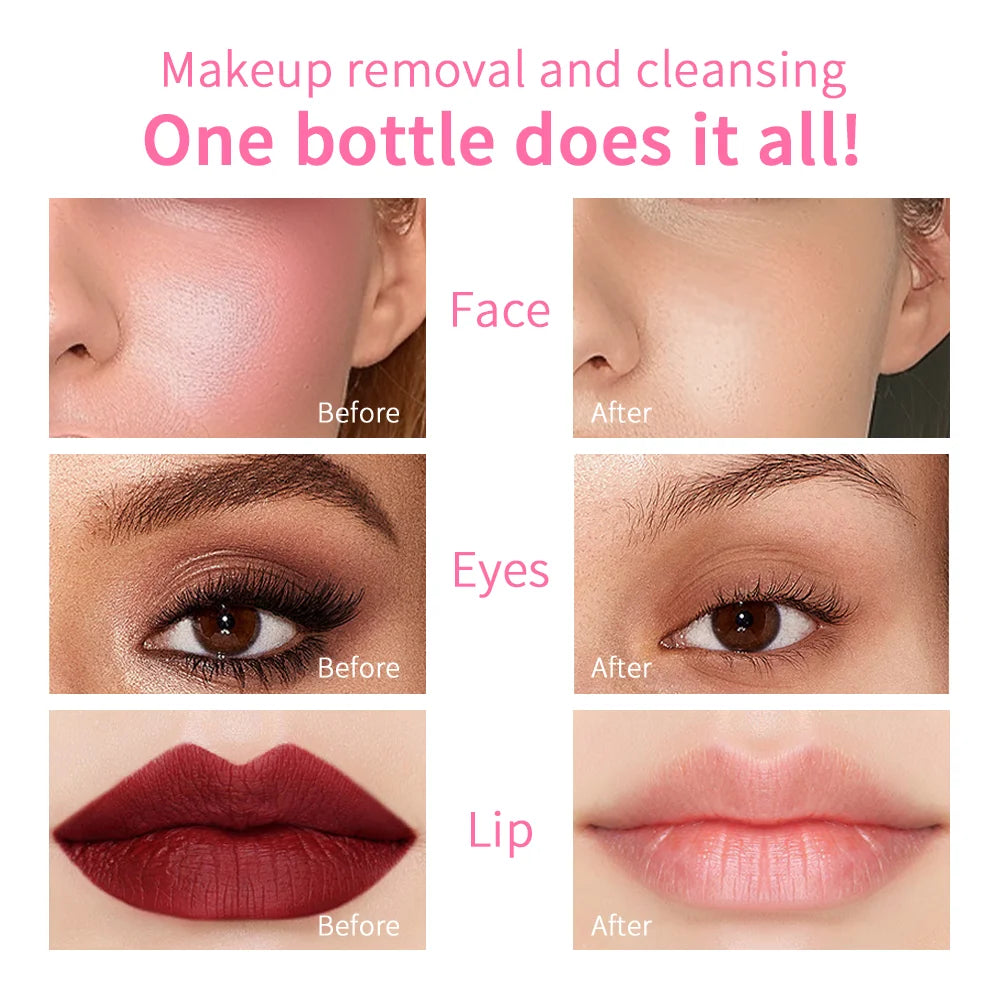 100ml Garnier Micellar Water Hydrating Facial Cleanser Deep Makeup Remover Cleaning Water Refresh Hydrate Cleansing Skin Peaceful Pleasures Health and Wellness