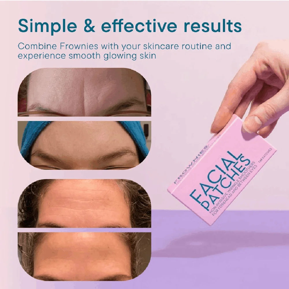 Anti-Wrinkle Patches – Forehead & Face Lifting, 144pcs