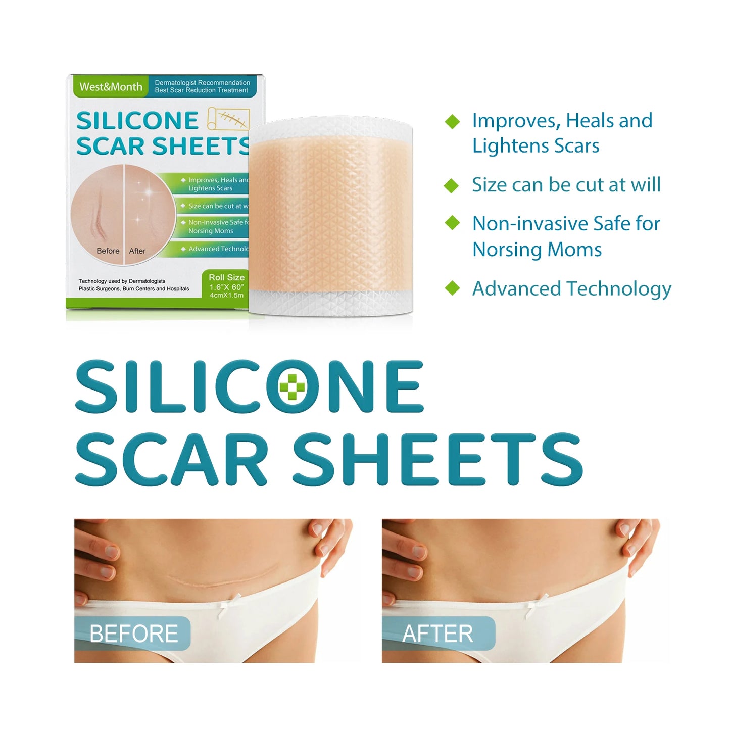 Silicone Scar Sheets Roll 4cm×150cm | Reusable Scar Tape