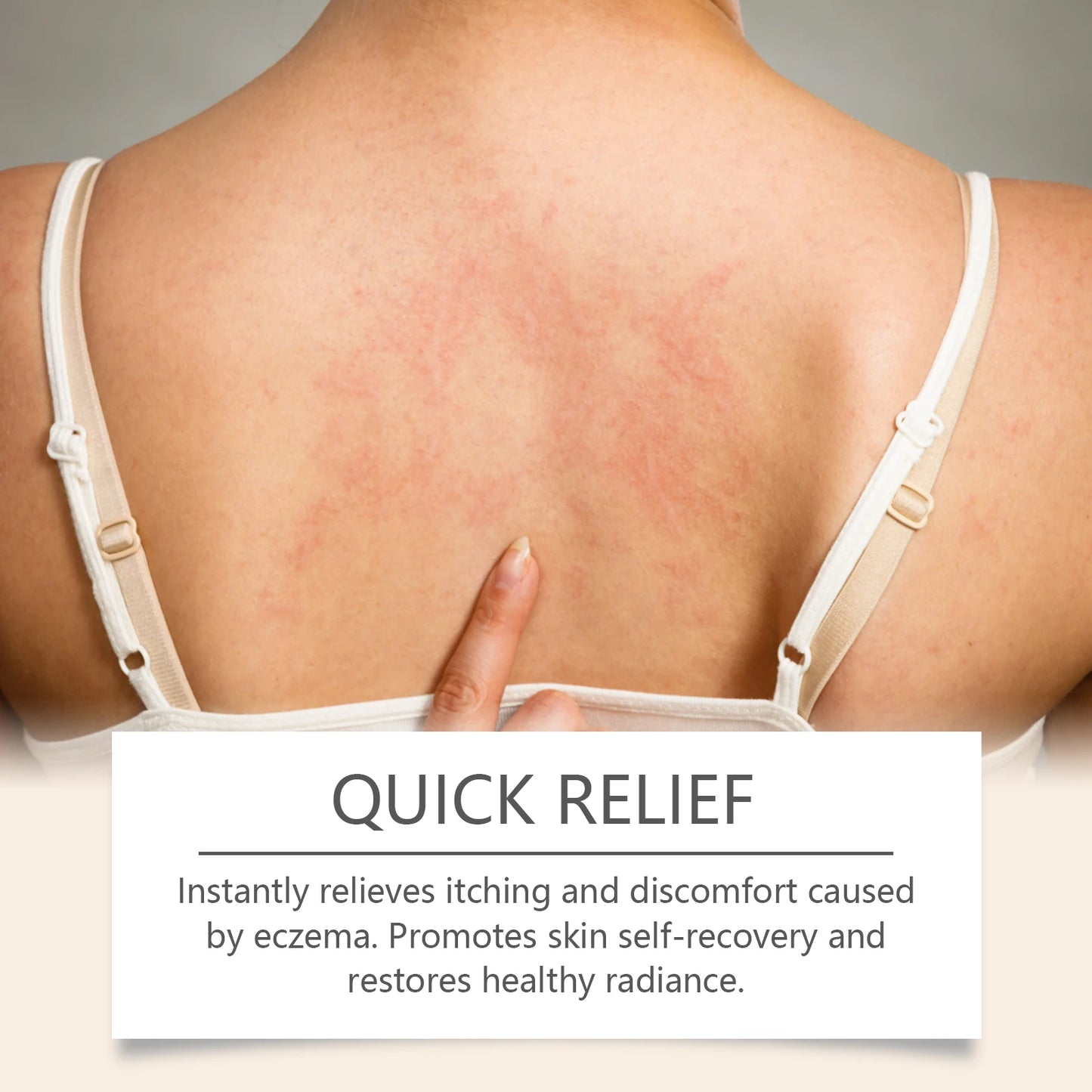 Ximonth Eczema Relief Cream | Moisturizing Skin Barrier Repair