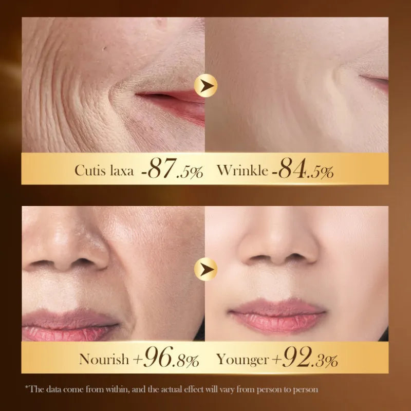SADOER Caviar DNA Sodium Collagen Frming Cream for Moisturizing Nourish Anti-age Skin Care 30g Peaceful Pleasures Health and Wellness