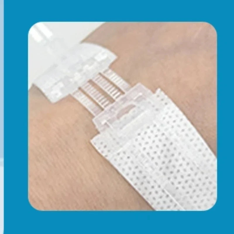 Zipper Wound Closure Strips | No-Suture Fast Closure Patch