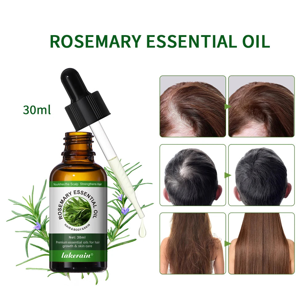 30ml Natural Essential Oils Plant Extract Serum Massage Oil For Hair Skin Body Relax Black Seed Oil Rosemary Oil 1 Bottle Peaceful Pleasures Health and Wellness