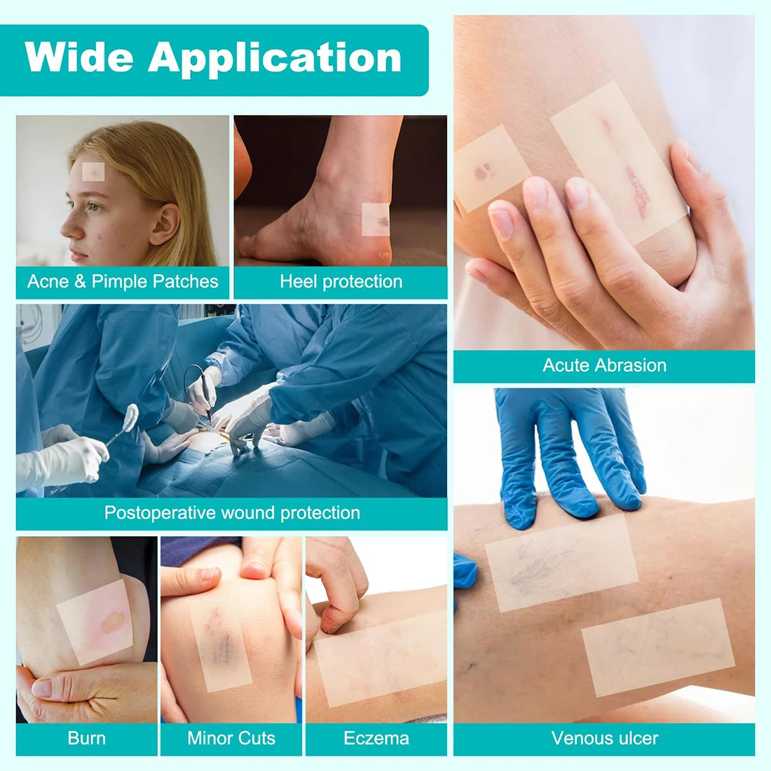 Hydrocolloid Wound Care Roll – Waterproof Self-Adhesive Bandage Dressing 5cm x 1.5m Peaceful Pleasures Health and Wellness