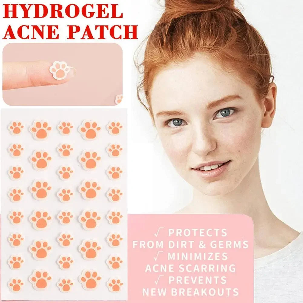 36 Counts Cat Paws Hydrocolloid Acne Pimple Patch Cute Acne Care Cover Patch, Invisible Acne Zit Patches For Face Dots Blemish Peaceful Pleasures Health and Wellness