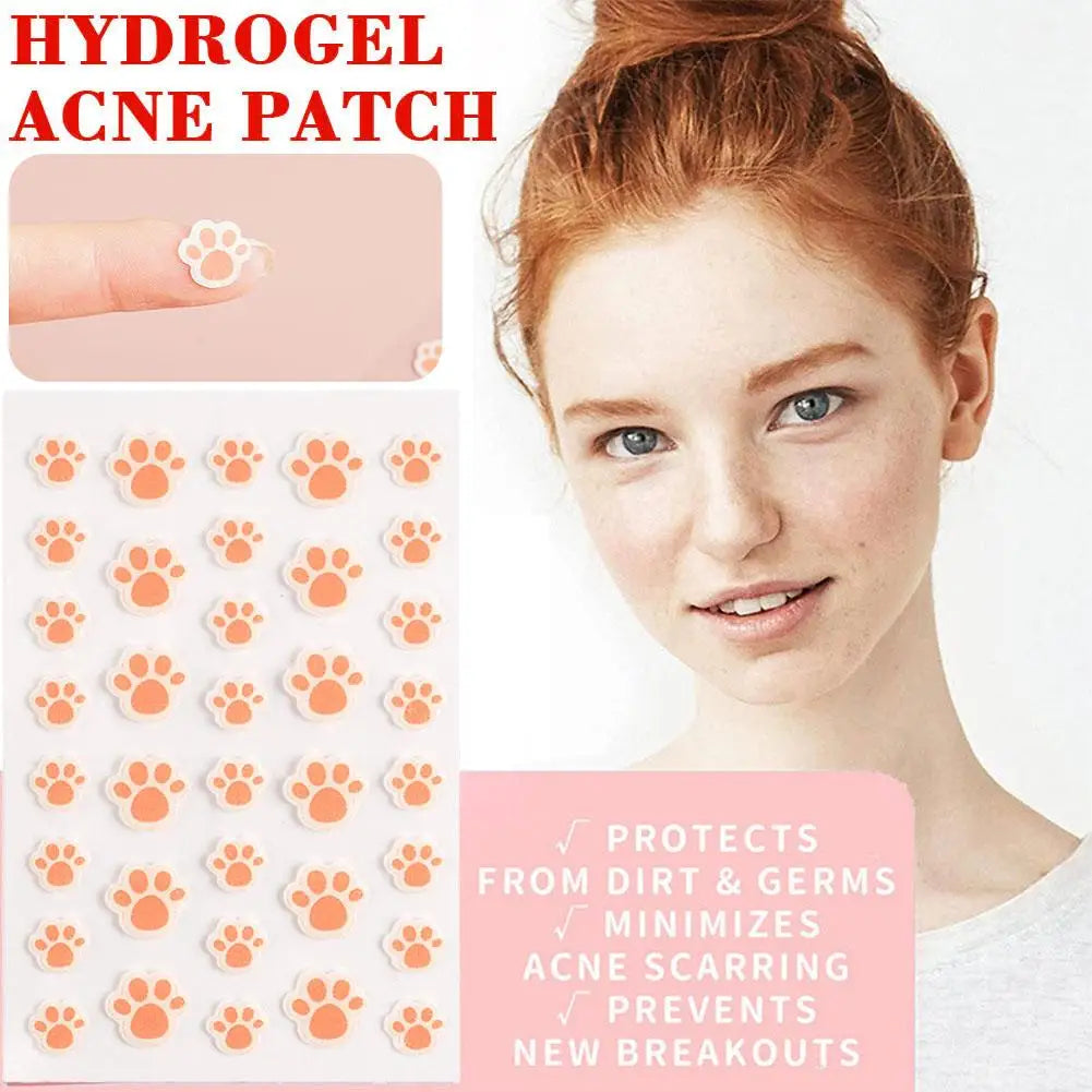 Cat Paw Hydrocolloid Acne Patches – 36 Invisible Pimple Dots