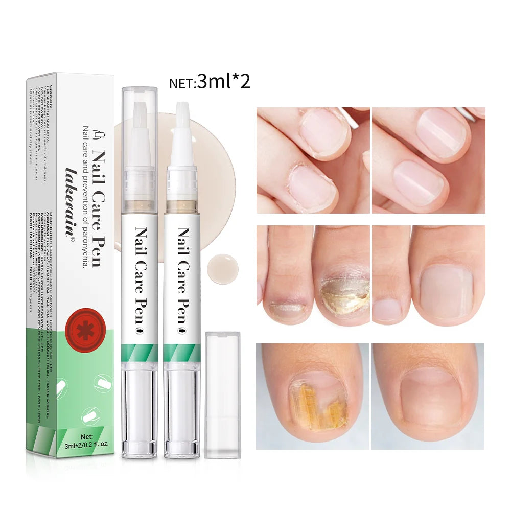 Nail Growth Oil Nail Treatment Cuticle Revitalizer Oil Prevent Agnail Nail Polish Nail Nutrition Oil Pen Manicure Nail Repair Peaceful Pleasures Health and Wellness
