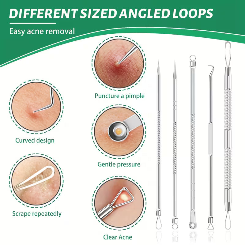 Acne removal tool set with instructions on how to use different sized angled loops.