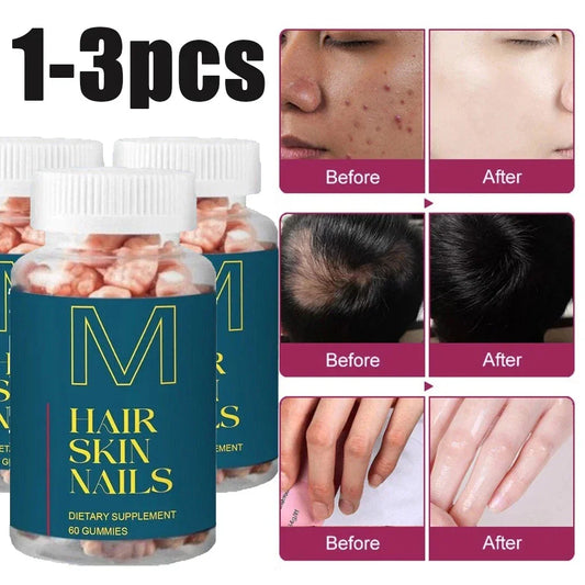 Hair Skin & Nails Gummies – Vegan Biotin + Collagen magnus_market