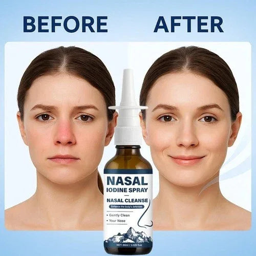 Iodine Nasal Spray – Nasal Cleanse & Refresh (60ml)